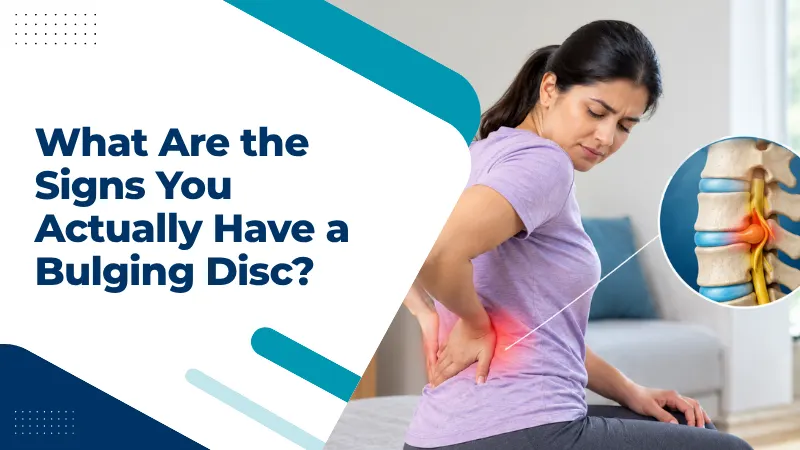 What Are the Signs You Actually Have a Bulging Disc