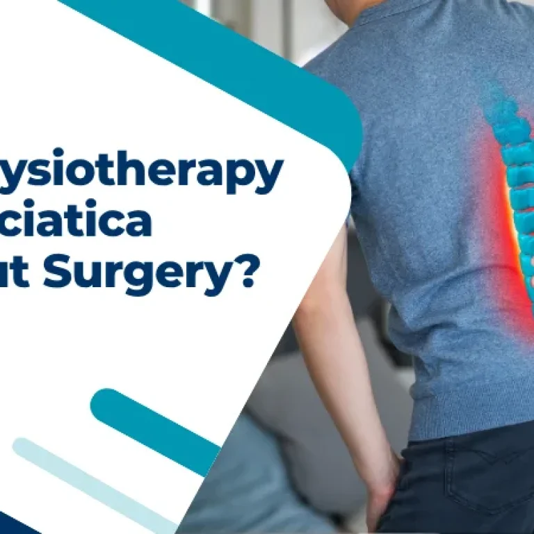 Can Physiotherapy Treat Sciatica Without Surgery