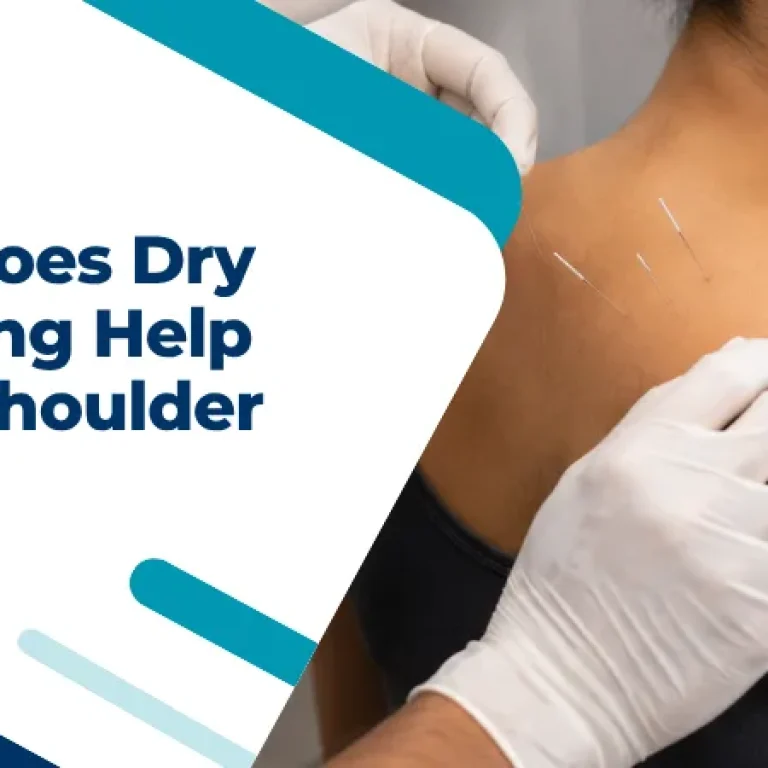 How Does Dry Needling Help With Shoulder Pain