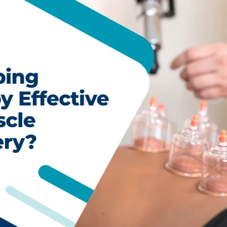 Is Cupping Therapy Effective for Muscle Recovery